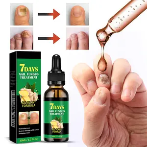 Toenail Fungus Treatment Extra Strength -Antifungal Nail Solution for Thick, Brittle &Discolored Nails - Undecylenic Acid & Ginger Extract, Fast-Acting Nail Repair, Vegan & Cruelty-Free