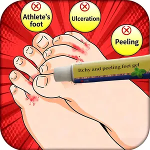 Foot cream for foot itching relief, desquamation, foot odor, toe itching, athlete’s foot, sweat reduction, softening foamy cream for cracked heels