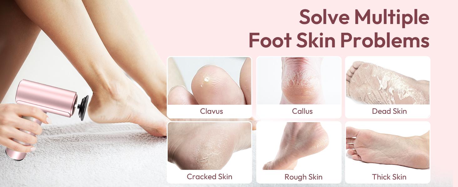 Electric Foot Callus Remover - 2 in 1 Rechargeable Electric Callus Remover for Feet, Pedicure Tools with 70pcs Sandpapers, Professional Foot Scrubber File for Dead Skin - Pink
