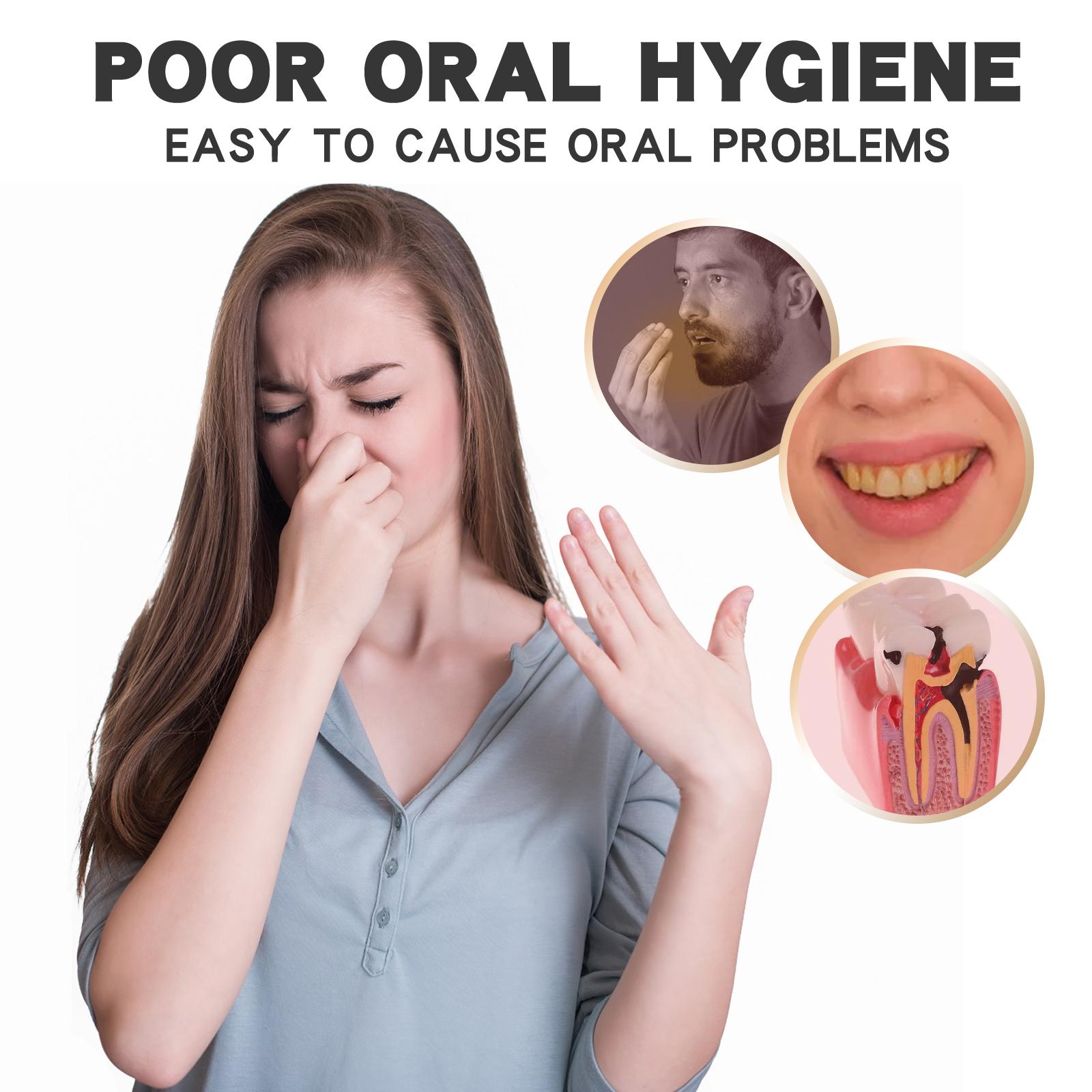 EELHOE Probiotic Whitening Toothpaste Removes Tooth Odor And Protects The Mouth. It Is A Daily Teeth Cleaning And Brightening Care Toothpaste