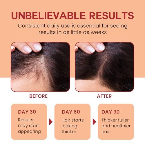 Lebanta Raw Batana Oil for Hair Growth - 100% Pure, Organic 4oz Batana from Honduras for Thick and Strong Natural Hair - Dr. Sebi Unrefined Cold Pressed Cosmetic Scalp Mask for Men & Women (1 Pack)