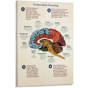 FGJERIO Brain Poster ,Vintage Anatomy Wall Art Trauma Brain Processing Diagram Poster Canvas Poster Wall Art Decor Print Picture Paintings for Living Room Bedroom Decoration 20x30inch(50x75cm)