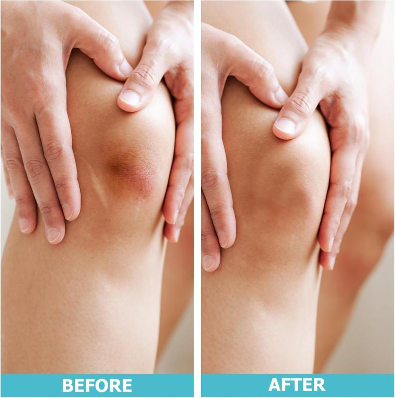 LIFARA Hydrocolloid Roll for Wound Care - Cut-to-Size, Extra Large Hydrocolloid Patch Bandages with Self-Adhesive, Ultra Absorbent, Flexible & Waterproof, First Aid Kit Essential (2in*16ft, 11.8mil/ 0.3mm Thickness))