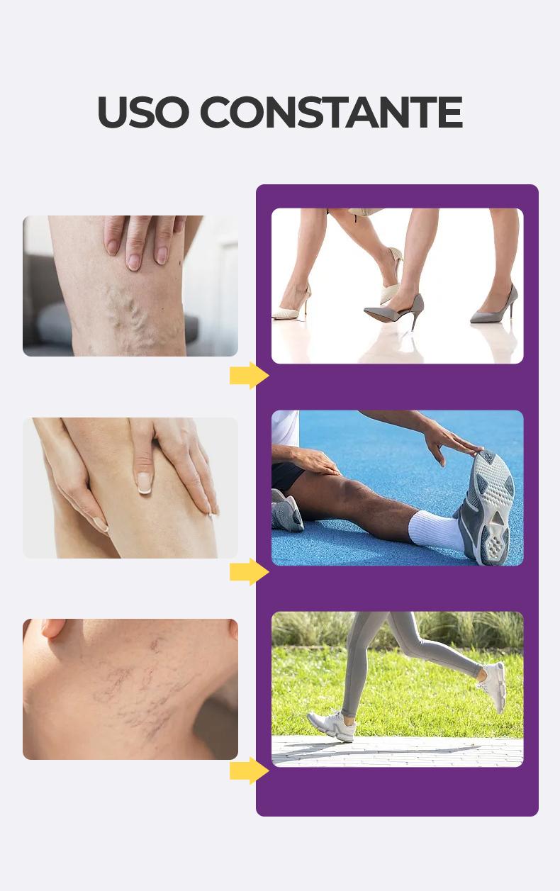 LOVILDS™ Varicose Vein Treatment Cream