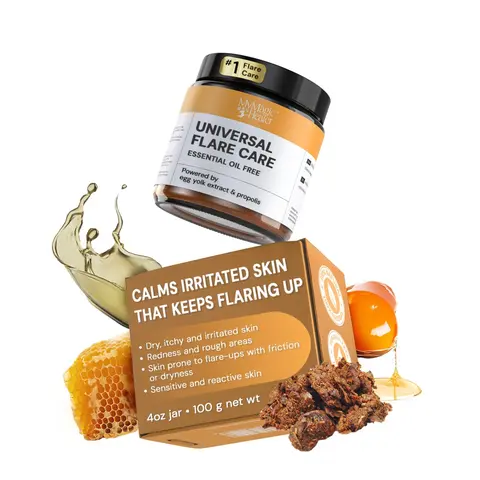 MyMagicHealer Universal Flare Care | Essential Oil Free | Relief for Rashes, Eczema, Psoriasis, Hidradenitis Suppurativa, Impetigo, Dermatitis, Wound Care, Sensitive Skin w/Propolis & Egg Yolk 4 oz
