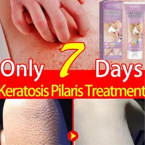 【New Arrival】Exfoliating Body Scrub - Smooth Skin & Reduce Bumps | Moisturizing Care for Strawberry Skin