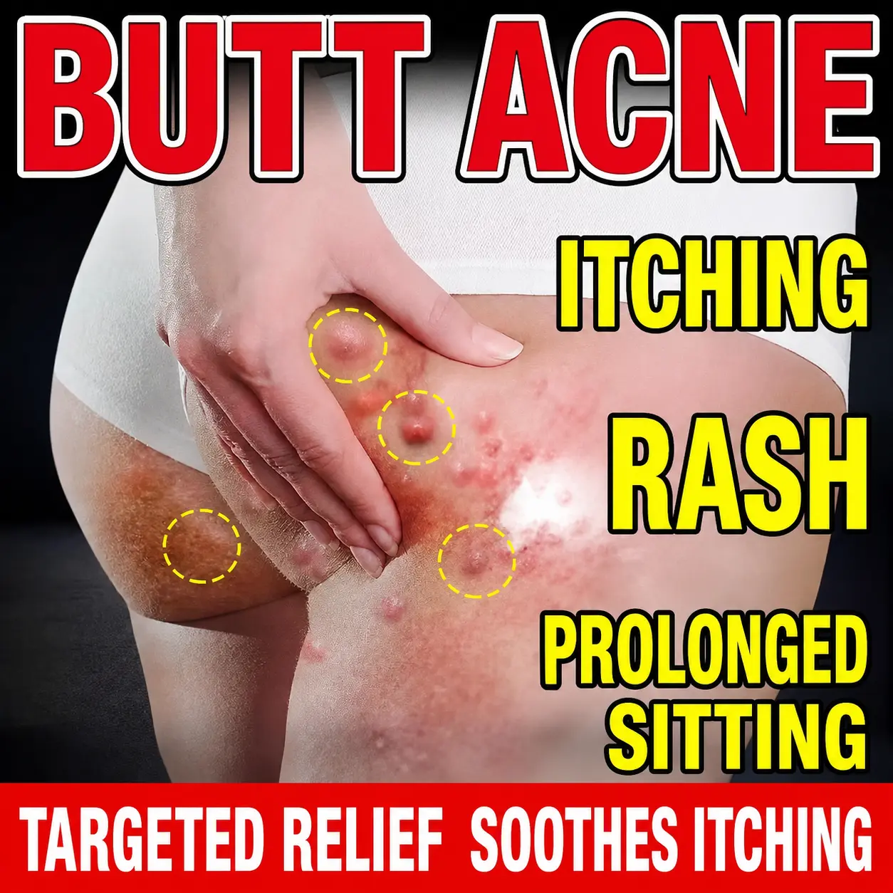 A soothing cream suitable for all over the body that relieves itching caused by seasonal allergies and eczema, thickens affected areas, and helps improve dry, itchy skin on the thighs and back where scales and plaques form. Its herbal formula is refreshin