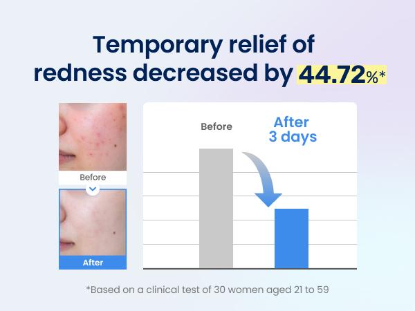 Sensitive Skin Soothing Duo (Propolis Rescue Ampule + Toner), Niacinamide with IP-BHA , Sensitive/Blemish Skin, Soothing, Hydrating, Mimizing Pores, Lightweight Facial Essence, Glass Skin, Korean Skincare (50ml+150ml)