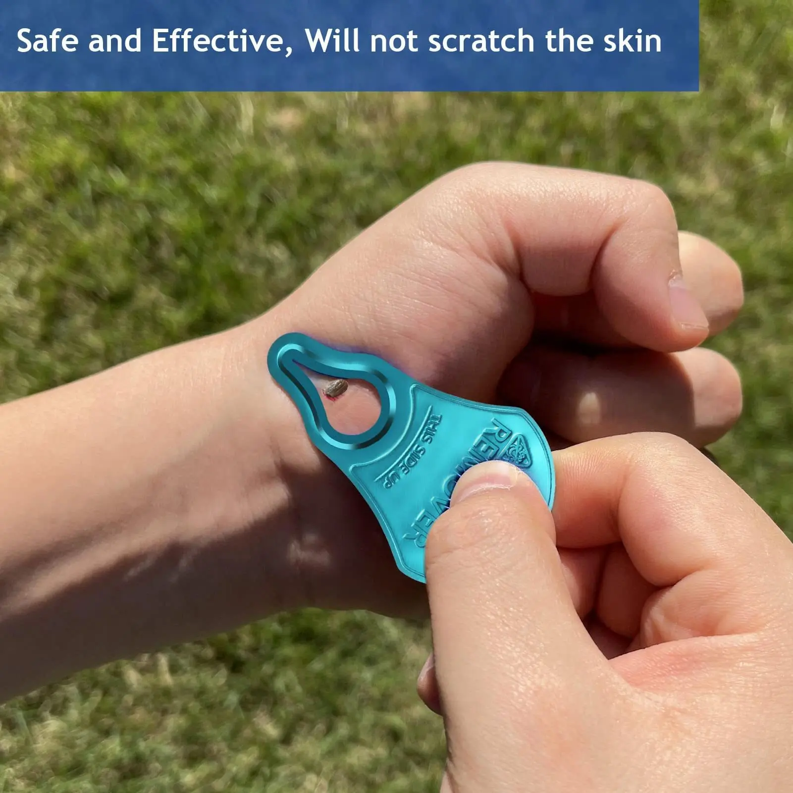 Outdoor Essential Tick Remover Kit, Professional 3-in-1 Tick Extractor Tool