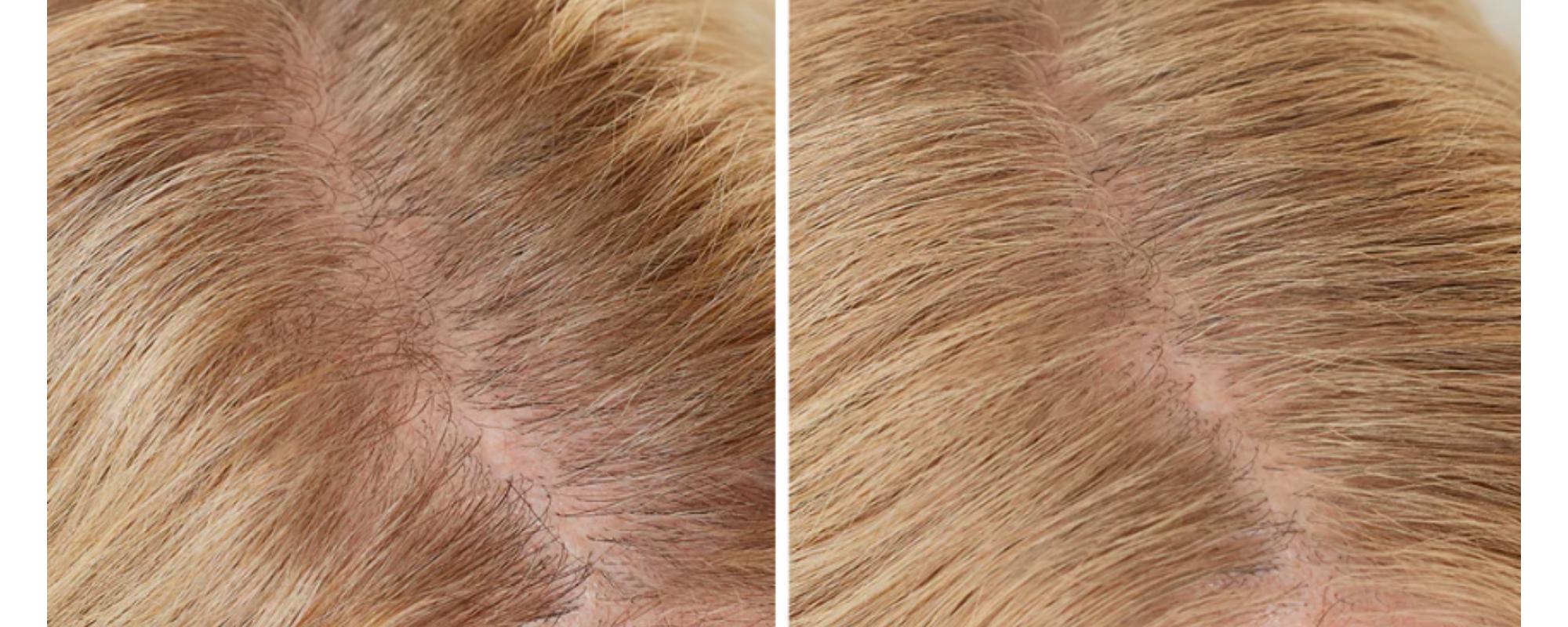 BOLDIFY Hairline Powder - Root Touch Up Hair Color for Gray Coverage, Blonde Refresh - 48-Hour Stain-Proof - Thickening & Concealing for Women & Men - Trending on TikTok