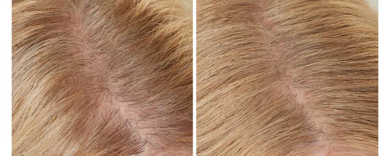 BOLDIFY Hairline Powder - Root Touch Up Hair Color for Gray Coverage - Bald Spot Concealing Hair Powder for Women & Men - 48-Hour Stain-Proof - Haircare Thickening BOLDIFY Hairline Powder - Root Touch Up Hair Color for Gray Coverage - Bald Spot Concealing Hair Powder for Women & Men - 48-Hour Stain-Proof - Haircare Thickening