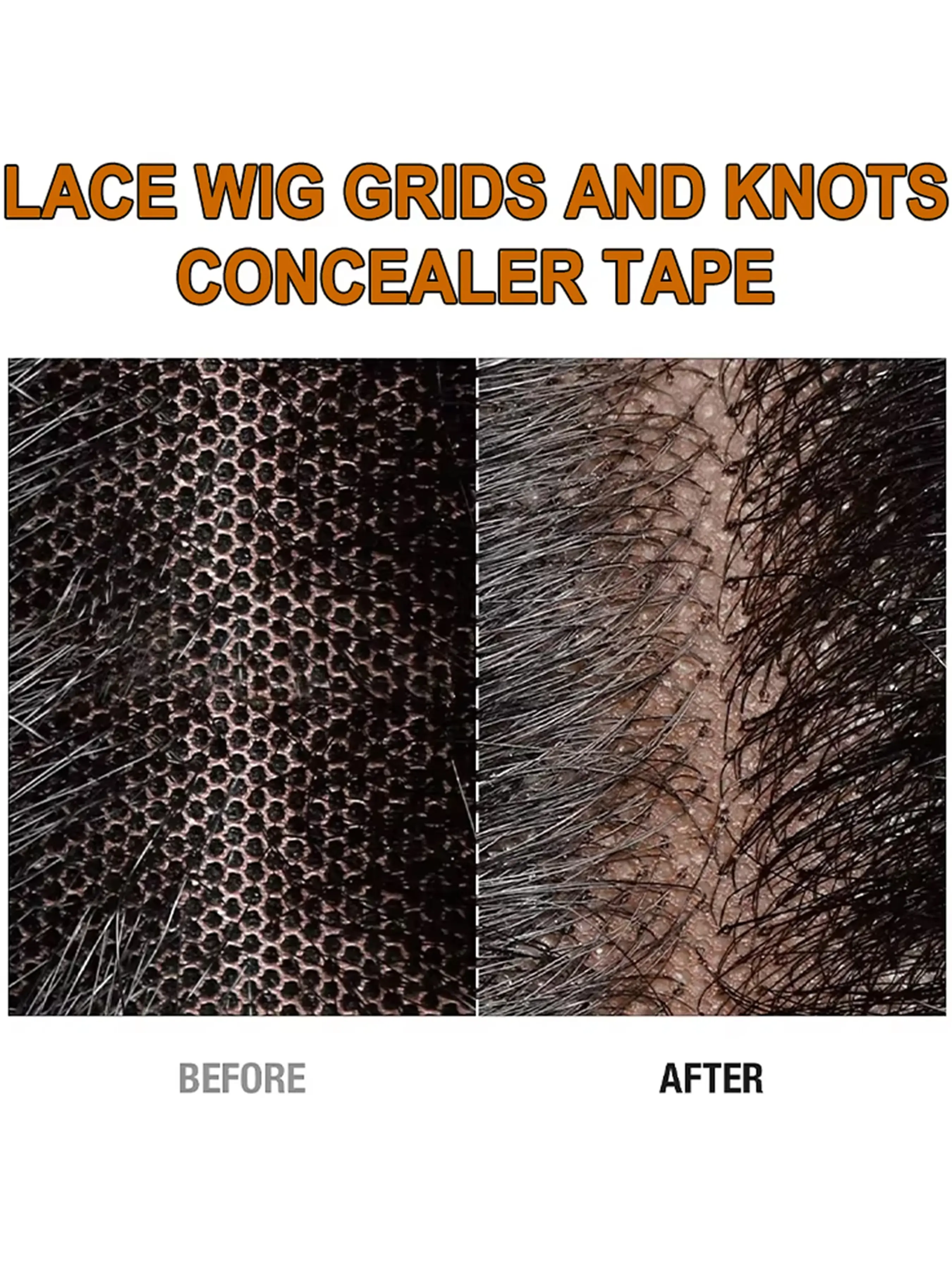 5-Piece Lace Wig Grid & Knot Invisible Fusion Tape, Breathable Hair Node Decoration Strap, Anti-Slip Hair Adhesive Tape, Wig Tool