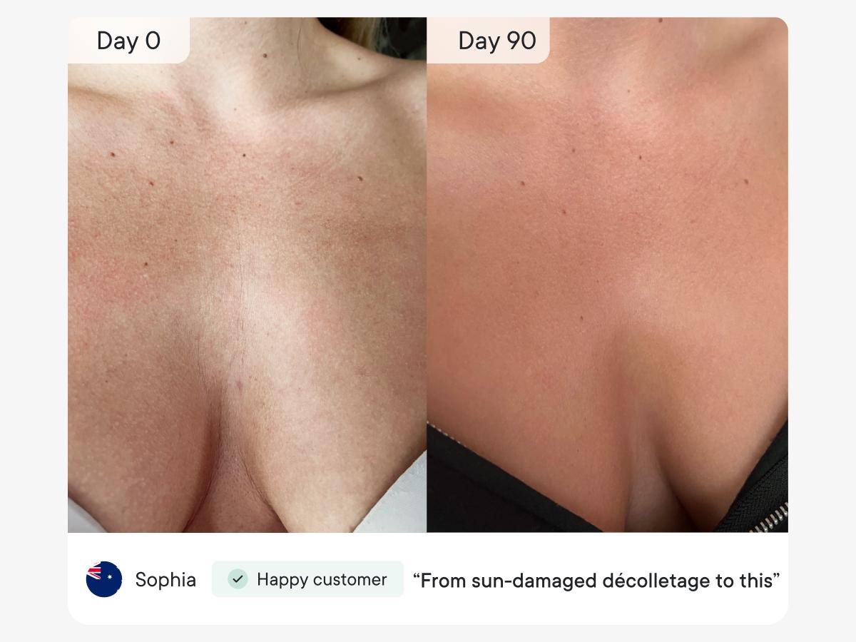 Qure Neck & Décolletage & Chest LED System, Red Light Therapy with 2 Wavelengths of Light, Red 633nm and Near-Infrared 830nmQure Neck & Décolletage & Chest LED System, Red Light Therapy with 2 Wavelengths of Light, Red 633nm and Near-Infrared 830nm