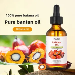Buriti Scalp Serum for Hair Growth |   Repairs Dry Scalp & Reduces Hair Loss |   60ml Haircare batana hair oil