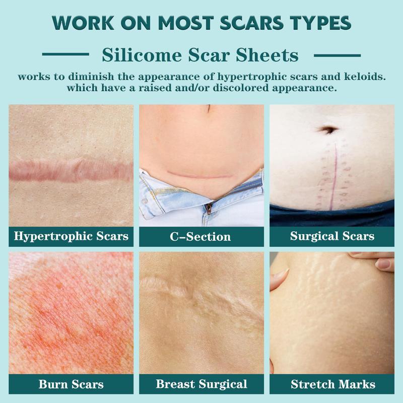Professional Silicone Scar Sheets king- Scars Removal Treatment-Anti-Aging, Dark Spot – Flexible Reusable Silicone Tape for Skin Care Routine