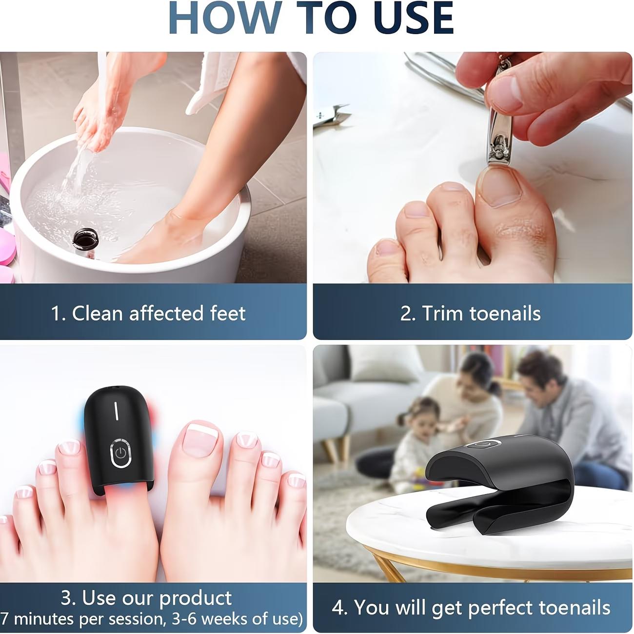 Nail Fungus Laser Treatment Device For Multiple Toenails - USB Rechargeable, Blue & Red Light Relax To Repair Discolored Or Damaged Nails At Home, Battery, Ergonomic Design For Comfortable Use