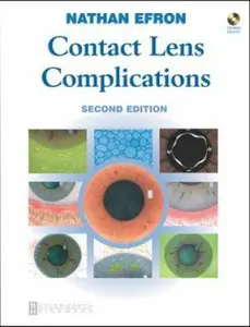 USED-Contact Lens Complications by Nathan Efron Efron  BSCOptom  PhD  DSc  FAAO  FIACLE  FCCLSA  FBCLA  FACO (Hardcover)