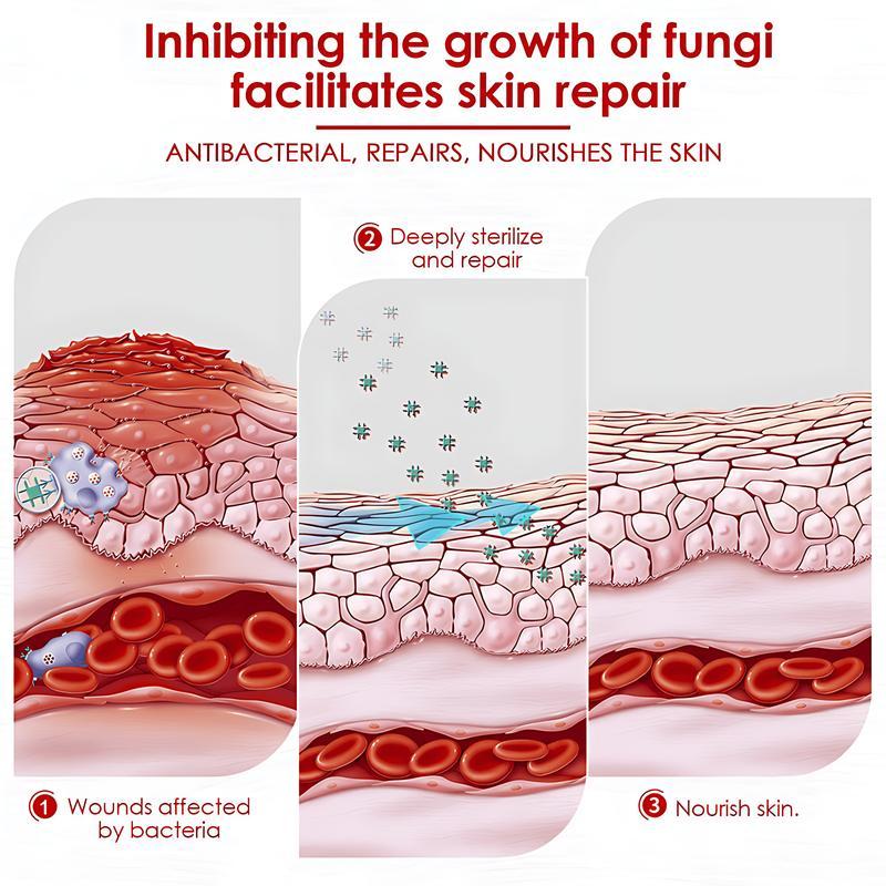 Premium All-Natural Herbal Soothing Cream for Psoriasis Eczema Dry Sensitive Skin Relief Plant-Based Itch Treatment Balm for Mosquito Bites 30g Hypoallergenic Skin Lotion