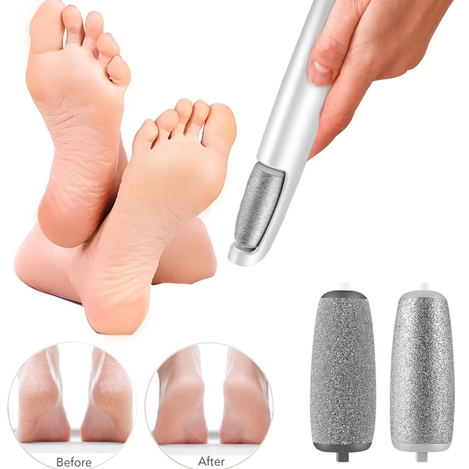 Portable Waterproof Foot Callus Remover - Efficient Solution for Your Needs