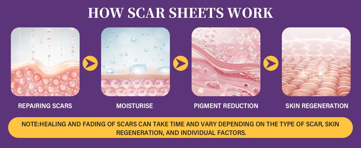 Silicone Scar Sheets,Silicone Scar Tape,Silicone Scar Removal Strips for Surgical,C-Section,Tummy Tuck,Keloid Scars (1.6"X 59" Roll-1.5M) Keloid Bump Removal