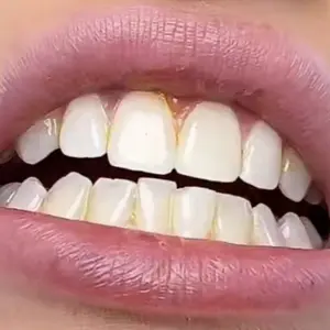 Purple mouthwash customer review photo