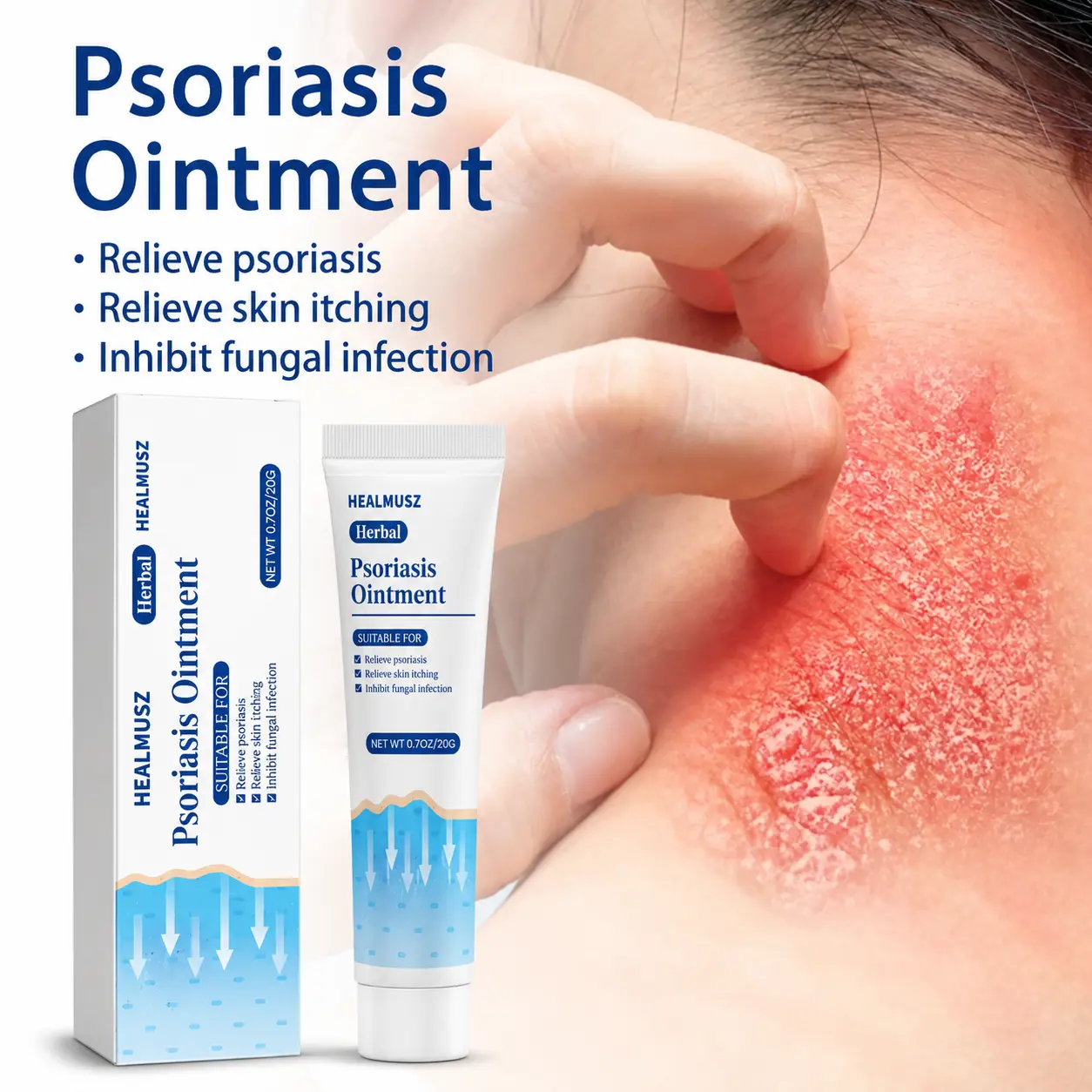 Maximum Strength Anti-Fungal Cream - Targets Psoriasis, Ringworm, Athlete's Foot, Tinea, Eczema - 100% Plant-Based - Soothes Itch, Repairs Dry Skin