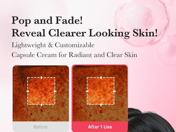 [medicube] TXA+Niacinamide Capsule Cream for After Spot Care Use|Ultimate Dual Radiance Moisturizer|Uneven Skin Tone, Texture, and Hydration l 99% Pure Tranexamic Acid & Niacinamide| Korean Skincare|1.94 oz