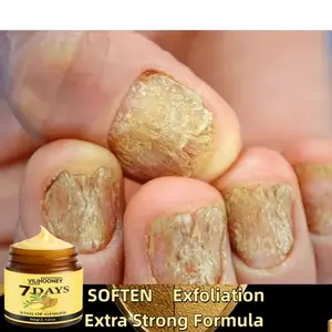 Fast-Acting Bee Venom Nail Care Cream, Plant Extracts & Bee Venom, Strong Penetration, Strengthen Nails, Remove Calluses, Repair Cracked Edges