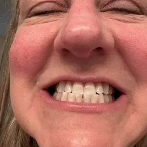 Product Review of GuruNanda Whitening Strips, 7-day treatment (7 Packets - 2 Strips per pack) - Non-Slip, Dry Strip Technology from L**a ** S**