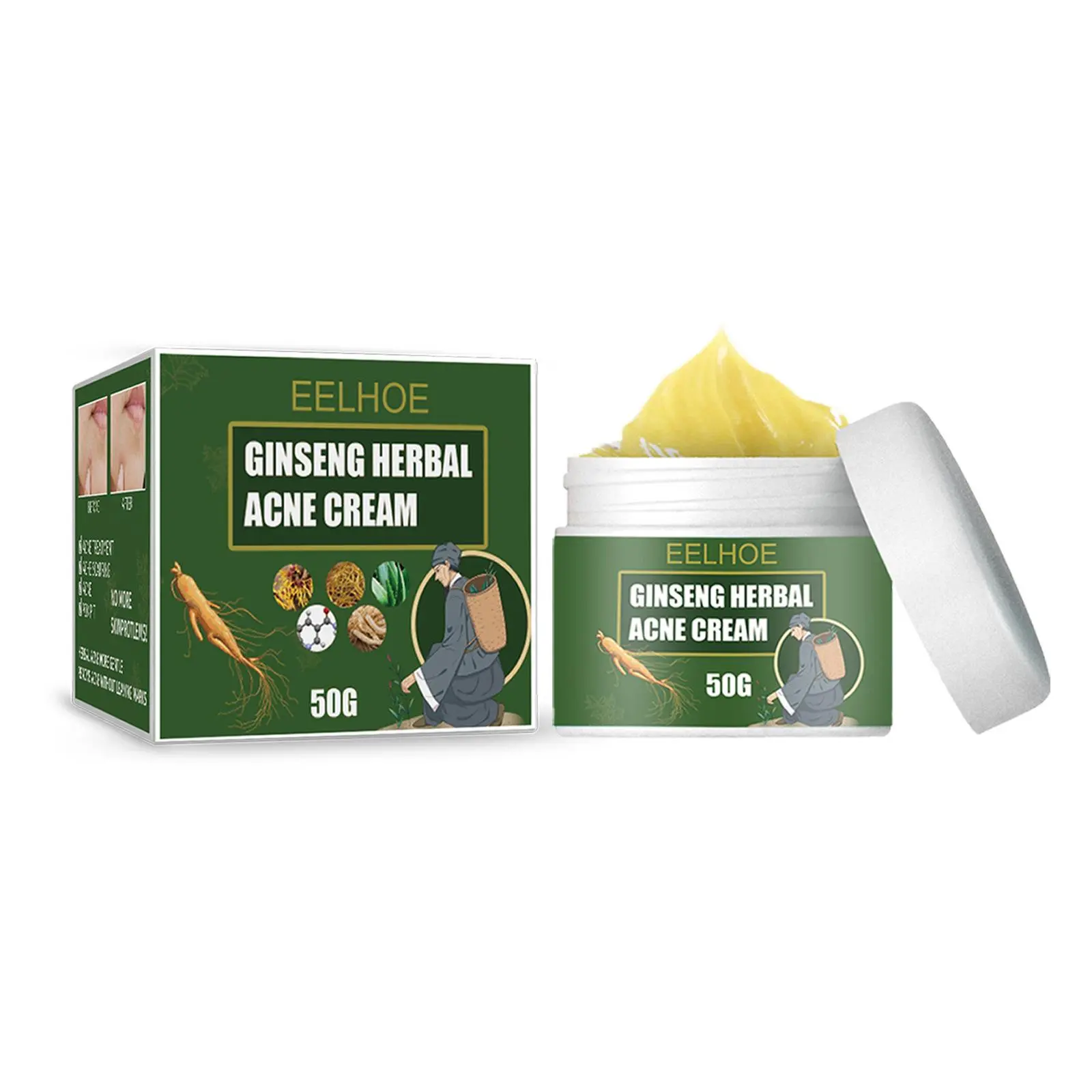 Eelhoe Herbal Acne Cream Acne Removal Smallpox Diluting Moisturizing Hydrating Cleansing Cream Water Oil Balance Anti-Acne Cream Moisturizer Moisture
