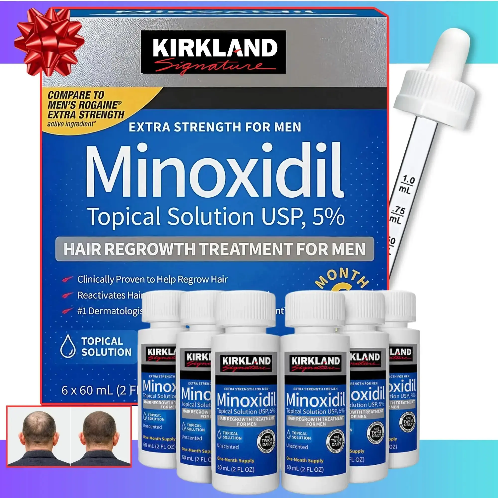 Minoxidil 5% for Men & Women Universal Solution for Pattern Baldness & Thinning Liquid Hair Growth Booster 3-Month Supply| Targets Hair Thinning at the Root, Enhances Hair Density & Supports Healthy Growth, Dermatologically Tested