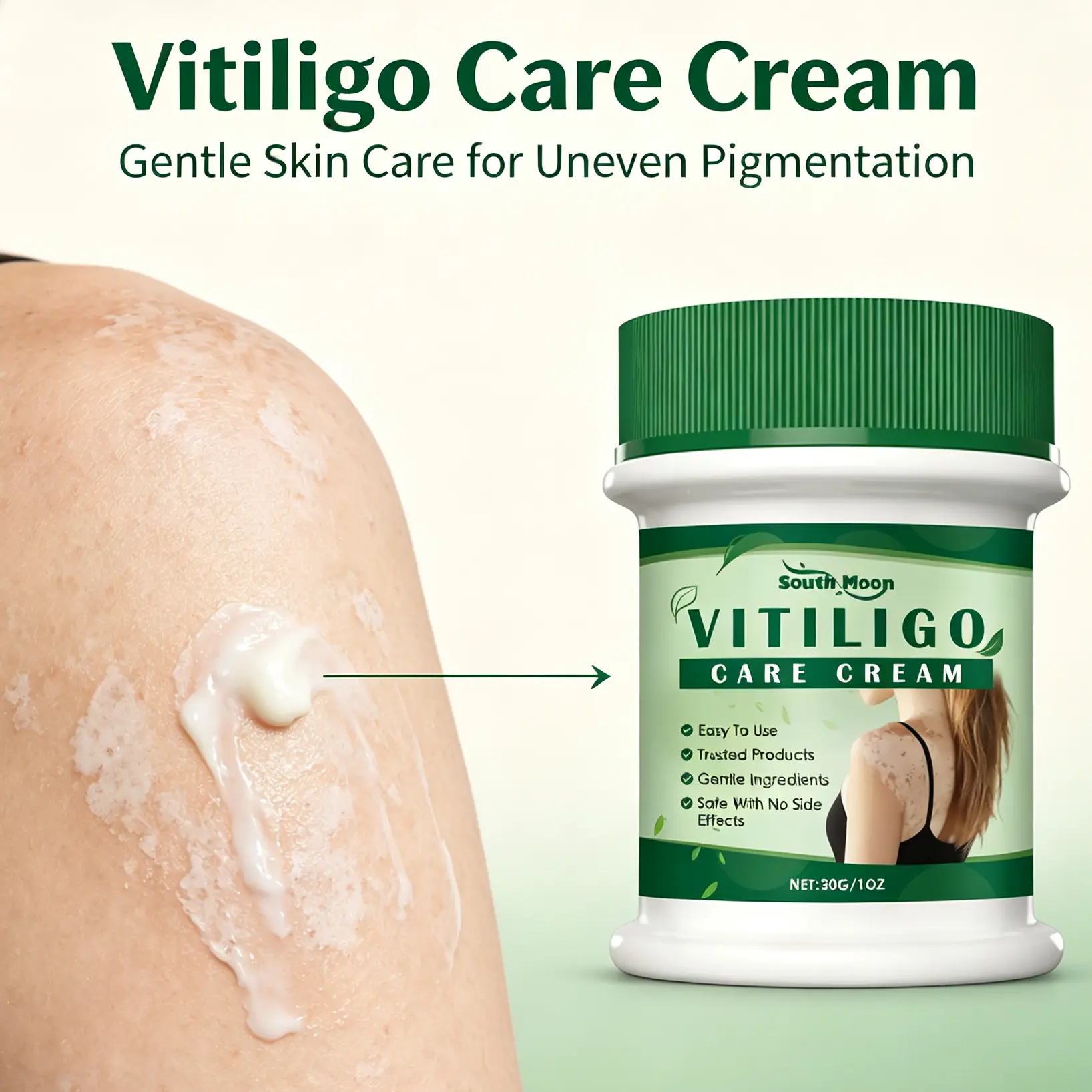 Vitiligo Care Cream,  Natural Herbal Formula to to Help Melanin Production,Reduce White SpotsSafe for Face & Body, Suitable for All Skin Types