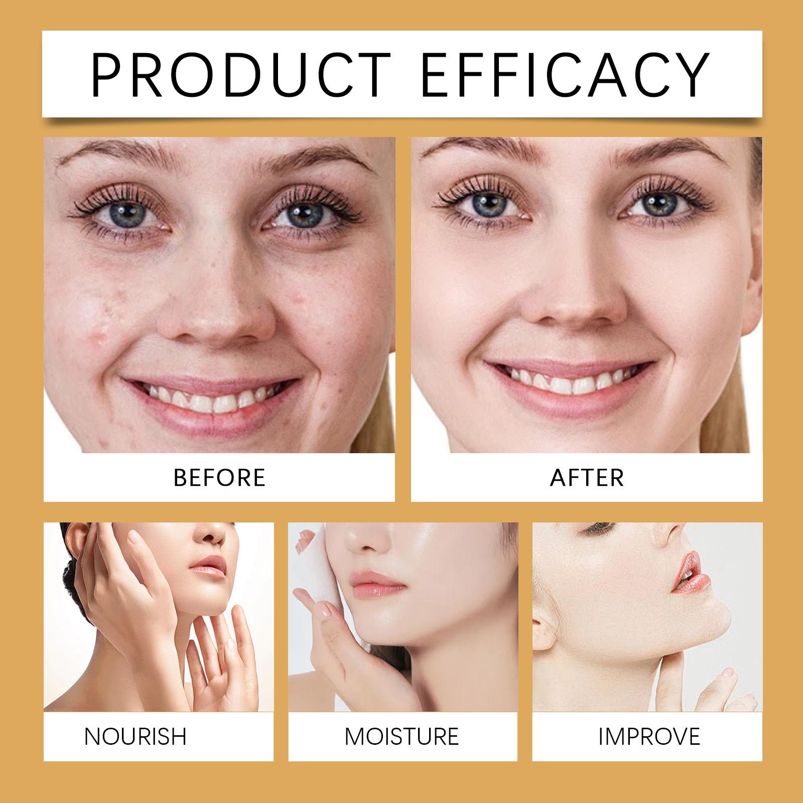 Viareline Vitamin C Brightening Serum Capsules - Dark Spot Corrector Skin Repair