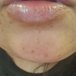 Product Review of [Laka] Soothing Prep Lip Mask — Cooling peel-off lip mask for smoother lip prep and a hydrated feel from R**👑