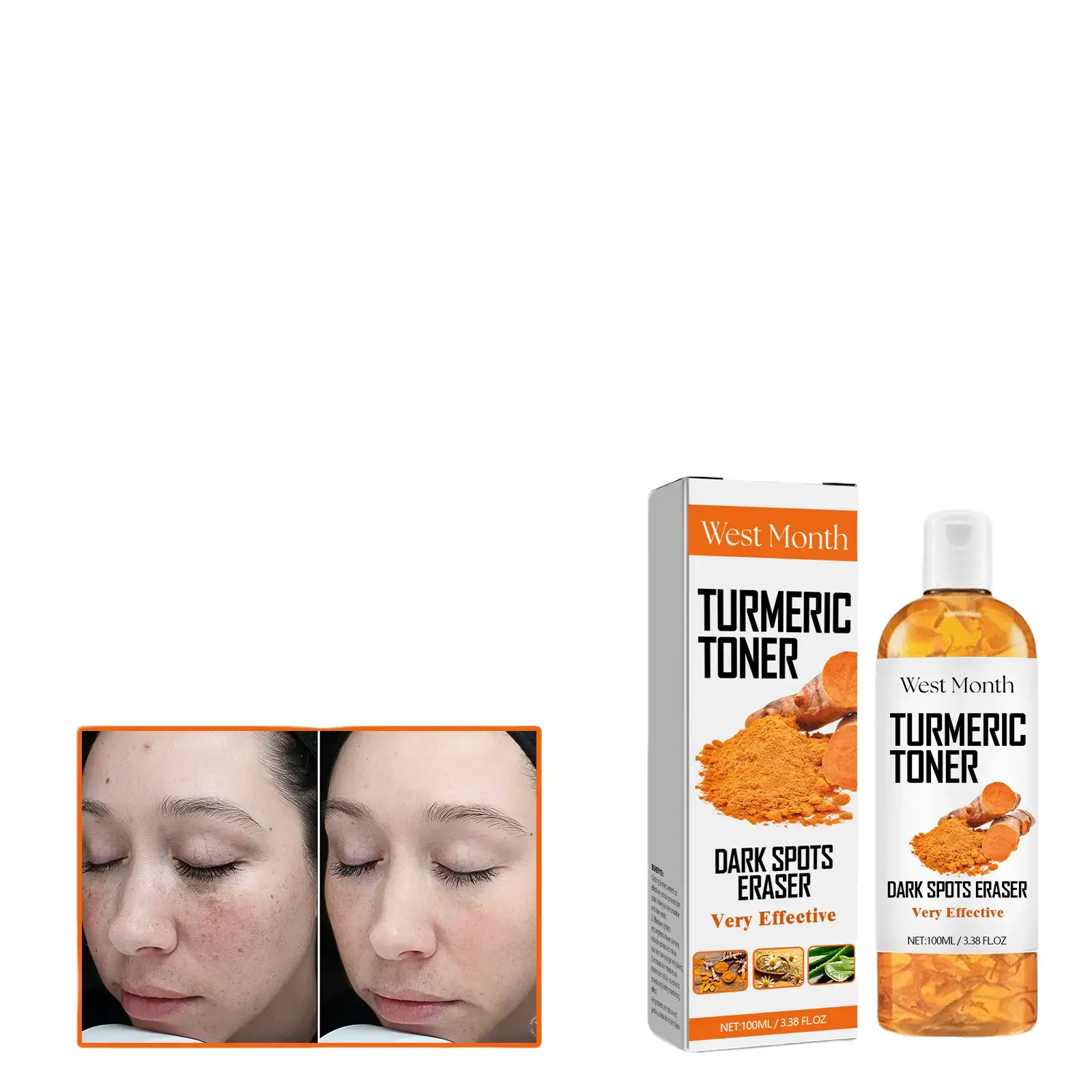 West&Month Darkening Turmeric Toner Deep Hydration Firming Moisturizing Facial Skin Toner Moisturizer Charcoal Cica Hyaluronic Korean Niacinamide