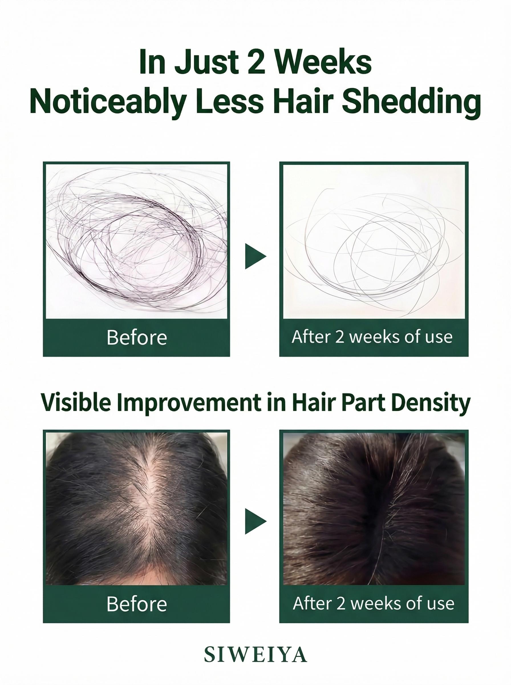 Korean Hair Growth Scalp Serum  with Built-in Scalp Massager— Peptide Complex Formula for Thinning Hair, Supports Fuller-Looking Strands, Plant-Based Bio-Active Care to Strengthen Roots & Soothe Scalp, Scalp Care Product. Haircare product, 100 ml