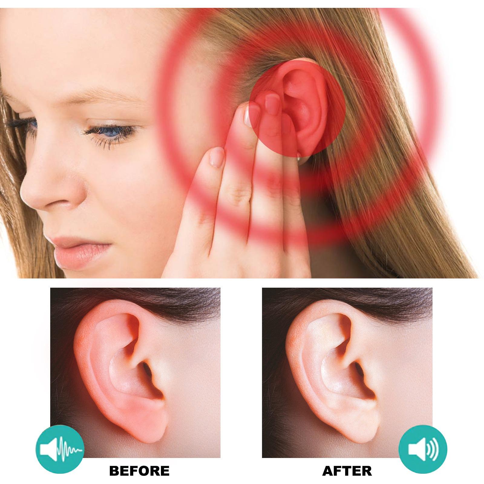 EELHOE Tinnitus Ear Drops Clean EarwaxRelieve Tinnitus