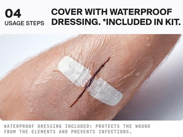 SURVIVEX Wound Closure Kit - Non-Invasive Skin Healing Solution for Cuts & Wounds - Gentle, Adjustable Tension, No Scarring, Easy Removal - All-in-One Emergency Healthcare Aid