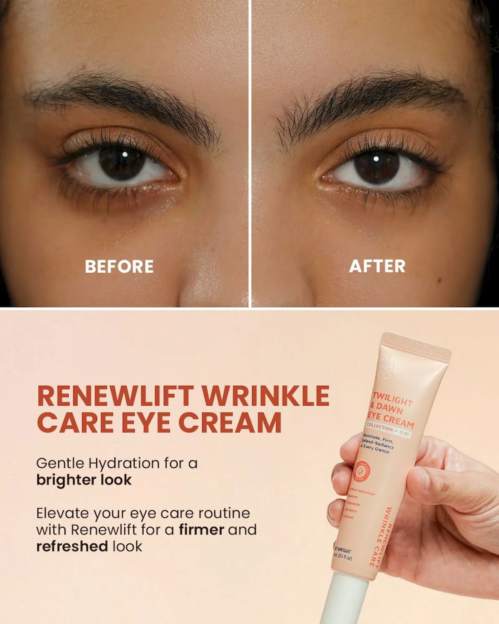 RUBY VIBE CO RenewLift Wrinkle Care Hydrating Eye Cream for Dark Circles, Retinol & Niacinamide Korean Eye Cream with Sodium Hyaluronate & Squalane, Lightweight Under Eye Cream, 0.5 lf oz (15ml)