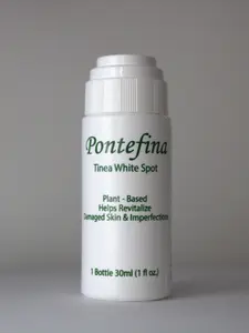 pontefina Antifungal Tinea Versicolor