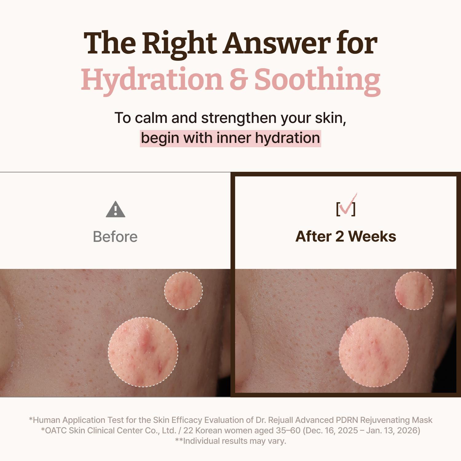 [Dr.Reju-All Official]Dr. Reju-All Advanced PDRN Rejuvenating Mask - Face & Neck Korean Sheet Mask with 1,200 ppm PDRN, Collagen & Copper Peptides - Hydrating & Soothing, Skin Repair (1.2 Fl Oz x 4EA)