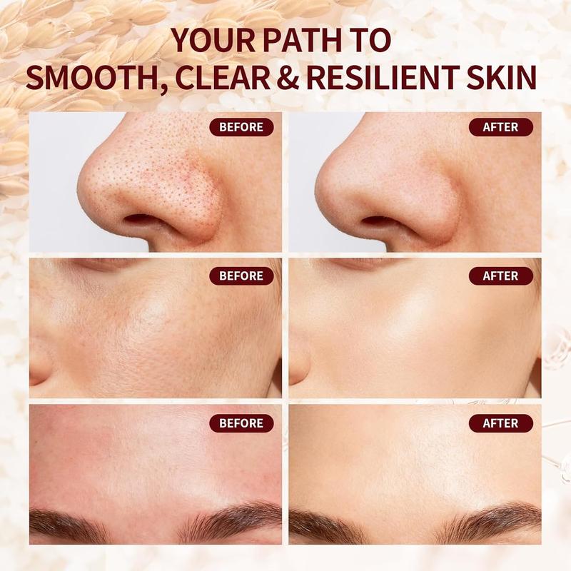 Jeirrzi Peeling Shot Glow Rice Exfoliant Ampoule, 5% Complext Acid Gentle Exfoliating Serum with Salicylic Acid, Brightening and Smoothing for Sensitive Skin