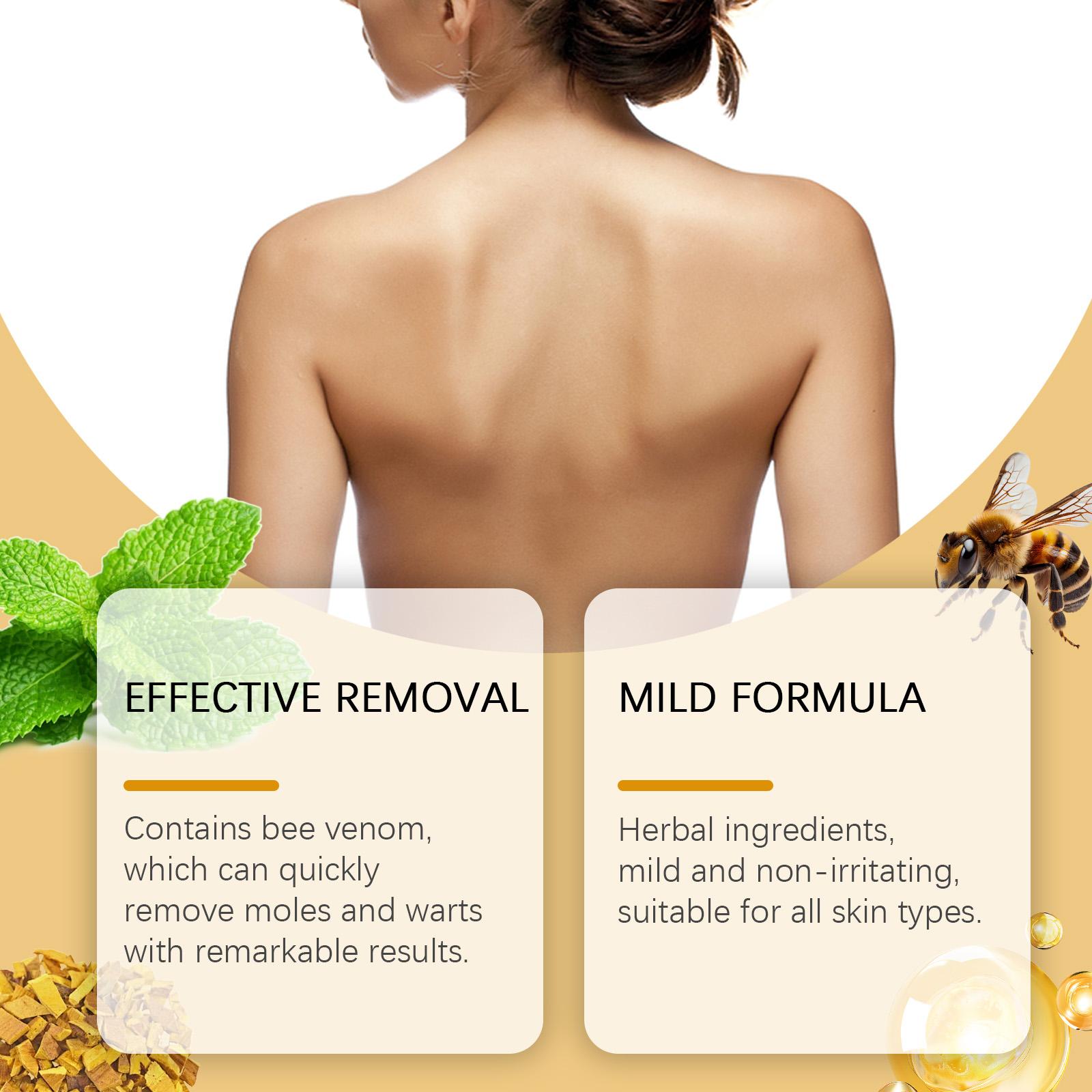 Wiyun Skin Care Cream Herbal Gentle Professional Treatment Psoriasis Cream for All Body Parts Clean Skin Wiyun Skin Care Cream Herbal Gentle Professional Treatment Psoriasis Cream for All Body Parts Clean Skin