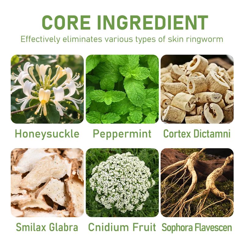 Umex All-Natural Plant-Based Herbal Relief Cream – Soothes Eczema, Psoriasis, Dry & Sensitive Skin | Ancient Botanical Formula for Whole Family Moisturizing Daily