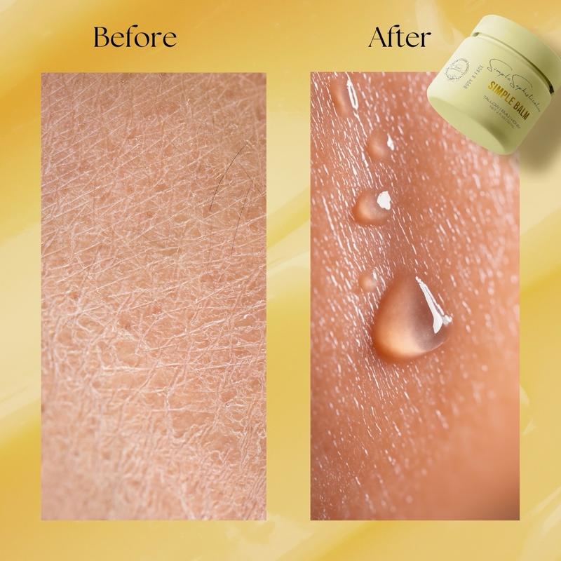 Tallow | Emu | Honey - Calming Balm with (Ashwagandha & Rosehip) | Beef Tallow Body & Face Cream | Moisturizer | Tallow Skincare suitable for sensitive skin, eczema, psoriasis, rosacea, mature skin