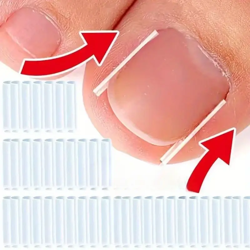 10/20/60 Pcs Nail Wraps, Nail Care, Odorless Inner Nail Strips for Correcting Ingrown Nails, Correction, Designed for Pedicure, Prevents Nail Growth Underneath