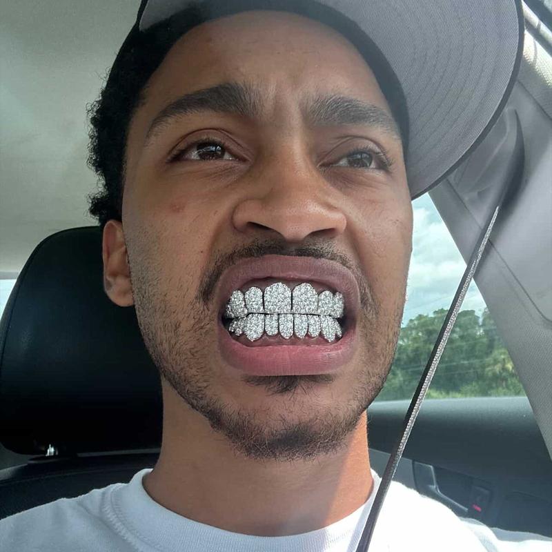 GBT Jumbo Set Round Cut Moissanite Diamond Grillz - Luxurious and Eye-Catching Design