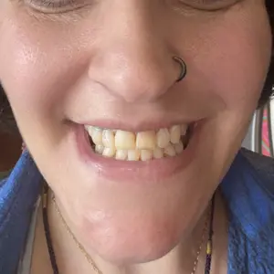 Purple mouthwash customer review photo