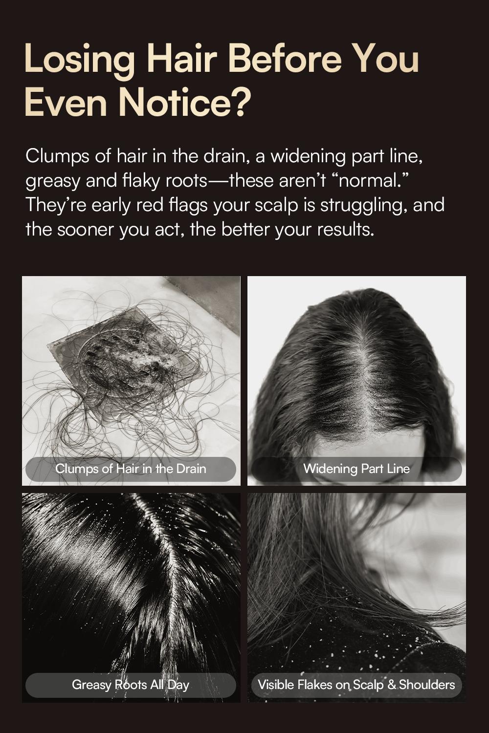 INIA VIBRA 4-in-1 Scalp Therapy Device, Red Light, Microcurrent, Massage, Serum Infusion, Scalp Massager Beauty Device, Waterproof & Wet/Dry Use, Perfect Holiday Gift