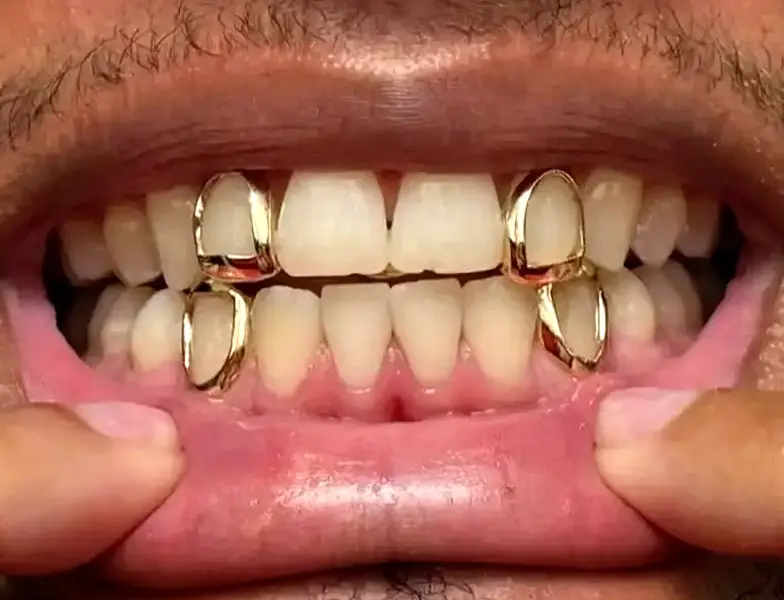 14K Gold Plated Open FAce Single Tooth Caps 4pc Grillz Set